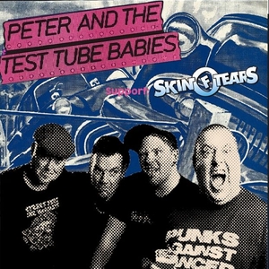 Skin of Tears @ Batschkapp